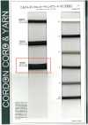 14SCR Cordón Recubierto De Silicona En Forma De V (Con Núcleo) De 10 Mm